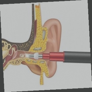 Comment utiliser Led Earpick Avec Chargement USB ?